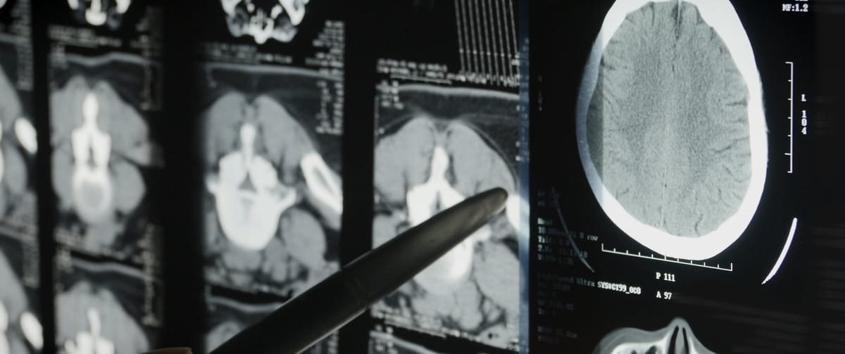 How to Build a Truth Engine